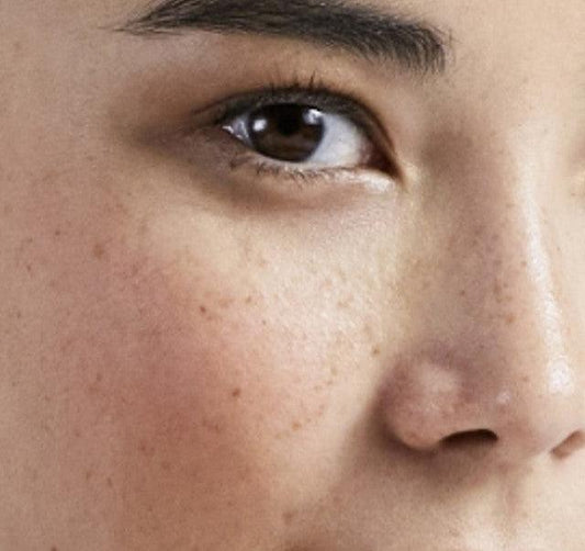 How to maintain skin results when taking Skin Accumax™